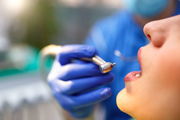 Dental Bonding in Avenue B And C, AZ